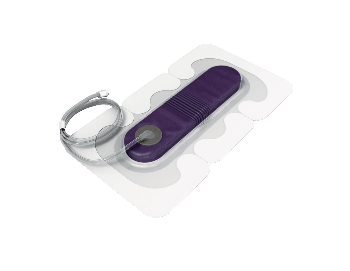 Prevena™ Peel and Place Dressing, PRE1055, 20 cm, 5 Dressings/Case - Medical Equipment - R25,599 | WiZmed Medical Equipment South Africa Prevena™ Peel and Place Dressing, PRE1055, 20 cm, 5 Dressings/Case - Medical Equipment - R25,599 | WiZmed Medical Equipment South Africa