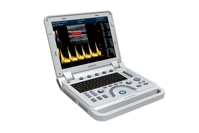 Contec CMS1700A Colour Doppler Ultrasound System - Ultrasound | WiZmed Medical Equipment South Africa Contec CMS1700A Colour Doppler Ultrasound System - Ultrasound | WiZmed Medical Equipment South Africa