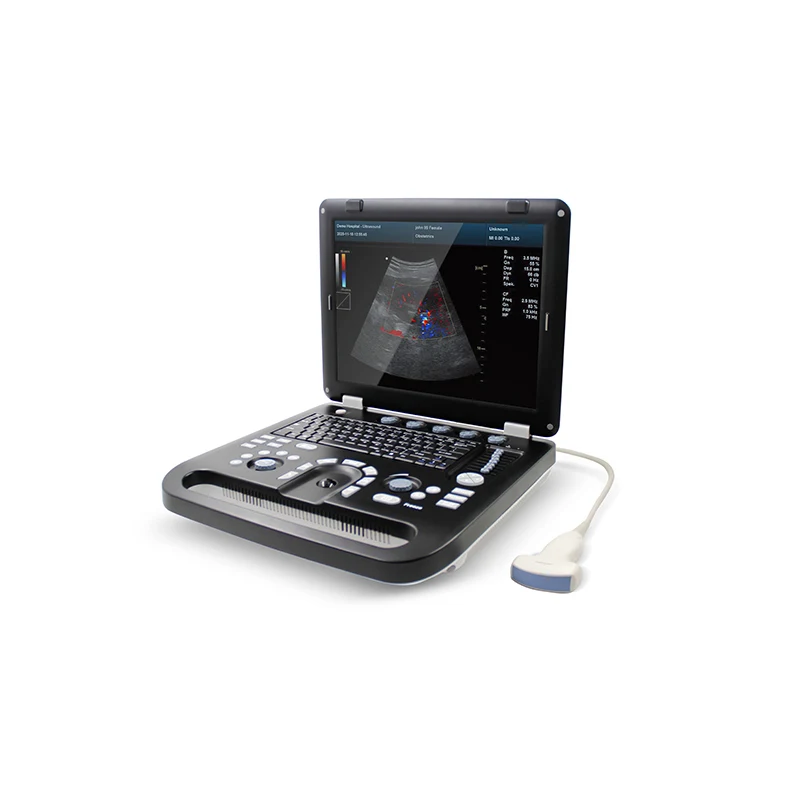 Contec CMS1700B-VET Colour Doppler Ultrasonic Diagnostic System (Veterinary) - Ultrasound | WiZmed Medical Equipment South Africa Contec CMS1700B-VET Colour Doppler Ultrasonic Diagnostic System (Veterinary) - Ultrasound | WiZmed Medical Equipment South Africa