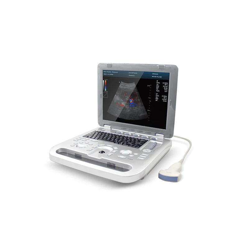 Contec CMS1700C-VET Colour Doppler Ultrasonic Diagnostic System (Veterinary) - Ultrasound | WiZmed Medical Equipment South Africa Contec CMS1700C-VET Colour Doppler Ultrasonic Diagnostic System (Veterinary) - Ultrasound | WiZmed Medical Equipment South Africa