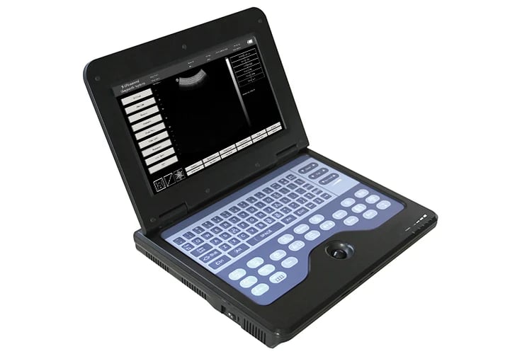 Contec CMS600P2 B-Ultrasound Diagnostic System - Ultrasound | WiZmed Medical Equipment South Africa Contec CMS600P2 B-Ultrasound Diagnostic System - Ultrasound | WiZmed Medical Equipment South Africa