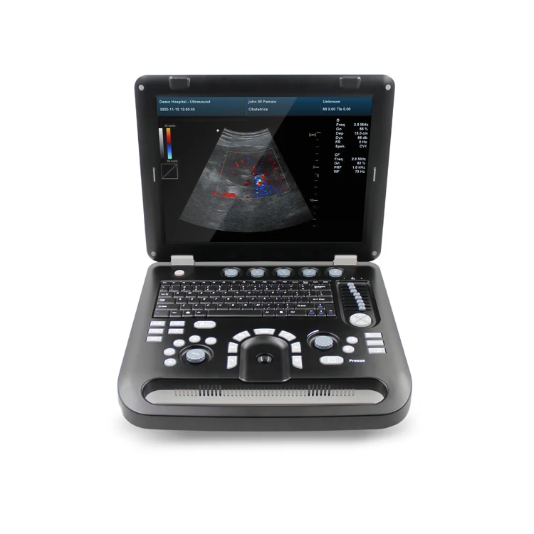 Contec CMS600P2PLUS B-Ultrasound Diagnostic System - Ultrasound | WiZmed Medical Equipment South Africa Contec CMS600P2PLUS B-Ultrasound Diagnostic System - Ultrasound | WiZmed Medical Equipment South Africa