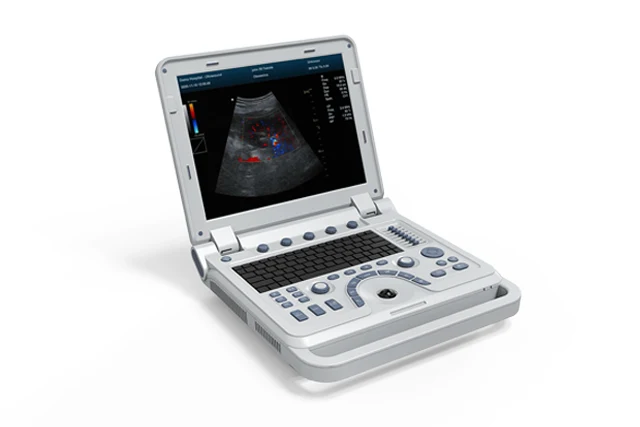 Contec CMS600P2PLUS-VET Veterinary B-Ultrasound Diagnostic System - Ultrasound | WiZmed Medical Equipment South Africa Contec CMS600P2PLUS-VET Veterinary B-Ultrasound Diagnostic System - Ultrasound | WiZmed Medical Equipment South Africa