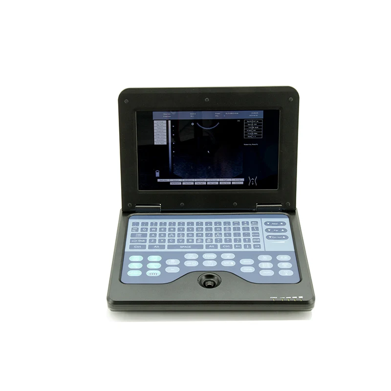 Contec CMS600P2VET Veterinary B-Ultrasound Diagnostic System - Ultrasound | WiZmed Medical Equipment South Africa Contec CMS600P2VET Veterinary B-Ultrasound Diagnostic System - Ultrasound | WiZmed Medical Equipment South Africa