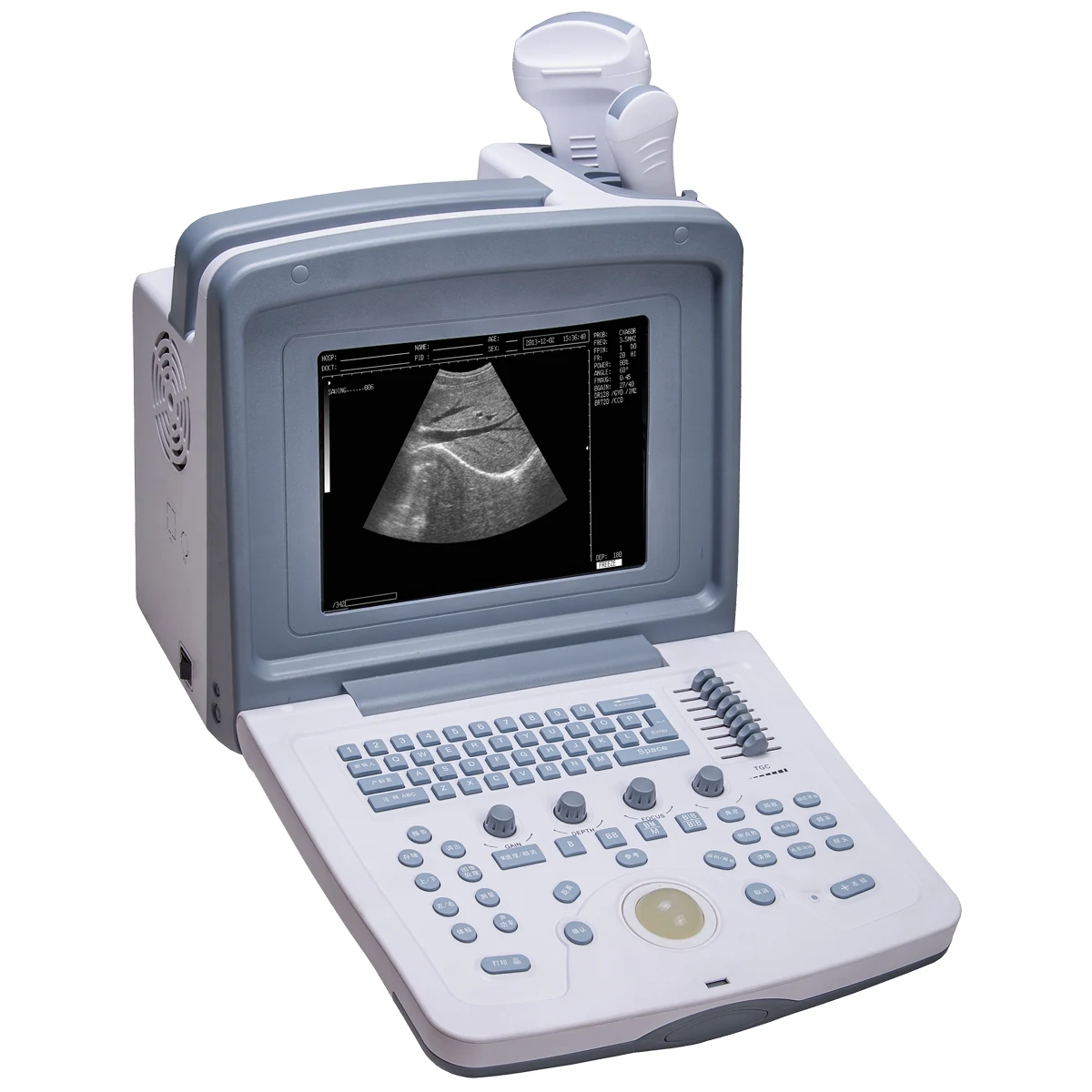 Welld WED-9618 Portable Ultrasound Scanner with Convex Probe - Ultrasound available at WiZmed for R44,299 Welld WED-9618 Portable Ultrasound Scanner with Convex Probe - Ultrasound available at WiZmed for R44,299
