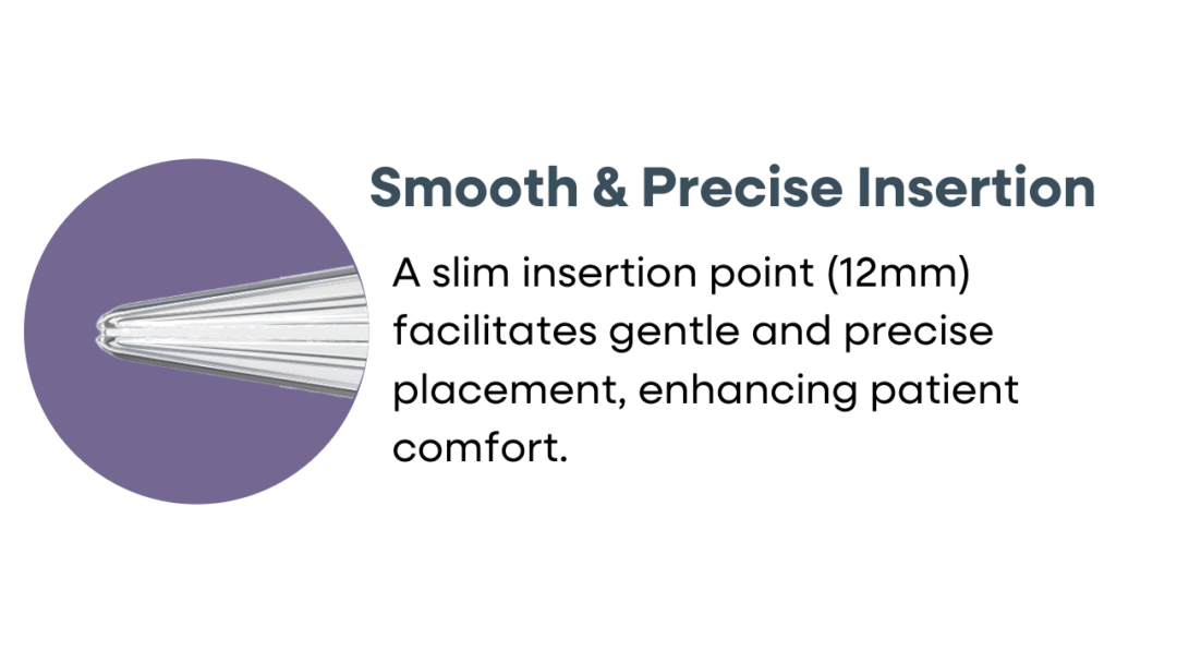 Bouquet Speculum™